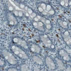 Immunohistochemical staining of human small intestine shows strong immunoreactivity in a subset of lymphoid cells (macrophages).