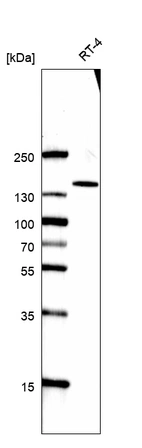 Western blot analysis in human cell line RT-4.