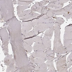 Immunohistochemical staining of human skeletal muscle shows no positivity in striated muscle fibers as expected.