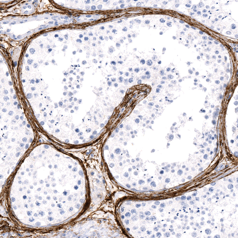 Anti-FBN1 Recombinant Antibody