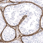 Anti-FBN1 Recombinant Antibody