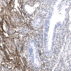 Immunohistochemical staining of human endometrium shows strong positivity in the extracellular matrix of stroma.