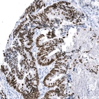 Anti-SATB2 Recombinant Antibody