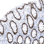 Immunohistochemical staining of human rectum shows strong nuclear positivity in glandular cells.