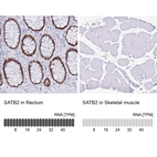 Immunohistochemistry analysis in human rectum and skeletal muscle tissues using AMAb90635 antibody. Corresponding SATB2 RNA-seq data are presented for the same tissues.