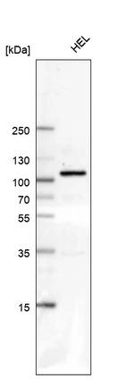 Western blot analysis in human cell line HEL.