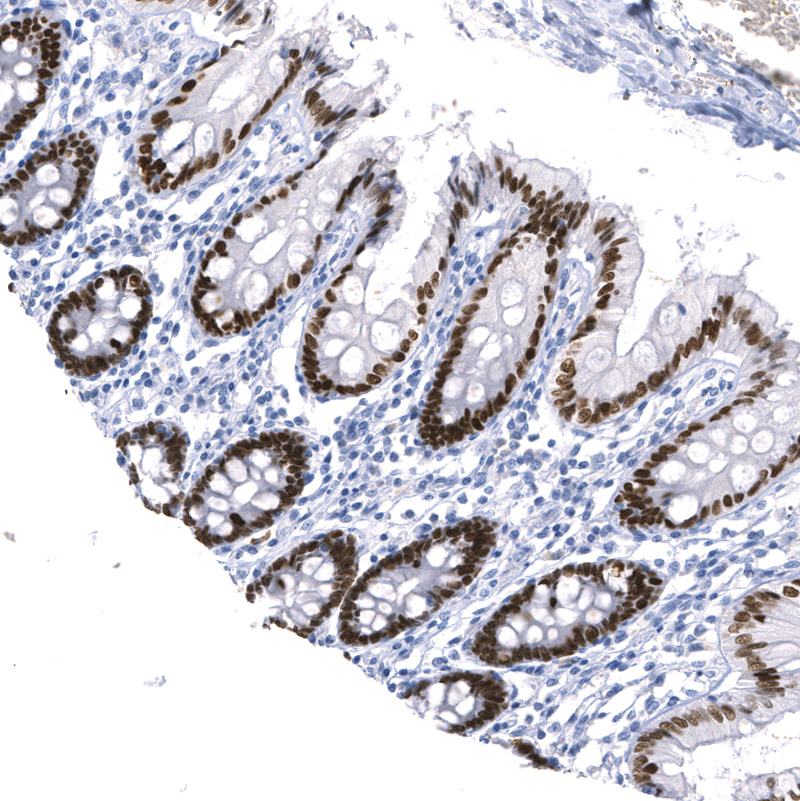 Anti-SATB2 Recombinant Antibody