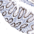 Anti-SATB2 Recombinant Antibody