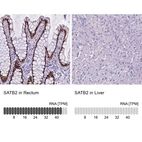 Immunohistochemistry analysis in human rectum and liver tissues using AMAb90682 antibody. Corresponding SATB2 RNA-seq data are presented for the same tissues.