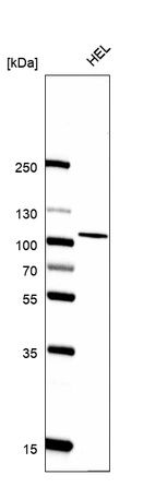Western blot analysis in human cell line HEL.