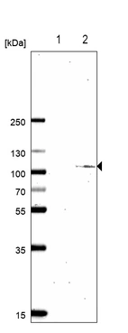 Western blot analysis in SATB2 over-expressed lysate. Lane 1: Negative control (vector only transfected HEK293T lysate) Lane 2: SATB2 over-expression lysate (Co-expressed with a C-terminal myc-DDK tag (~3.1 kDa) in mammalian HEK293T cells, LY414656).