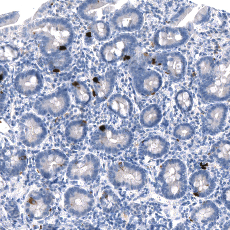 Anti-GDF15 Recombinant Antibody