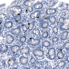 Anti-GDF15 Recombinant Antibody