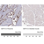 Immunohistochemistry analysis in human placenta and skeletal muscle tissues using AMAb90687 antibody. Corresponding GDF15 RNA-seq data are presented for the same tissues.
