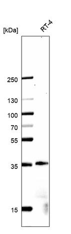 Western blot analysis in human cell line RT-4.
