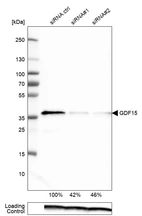 Western blot analysis in RT-4 cells transfected with control siRNA, target specific siRNA probe #1 and #2, using Anti-GDF15 antibody. Remaining relative intensity is presented. Loading control: Anti-PPIB.