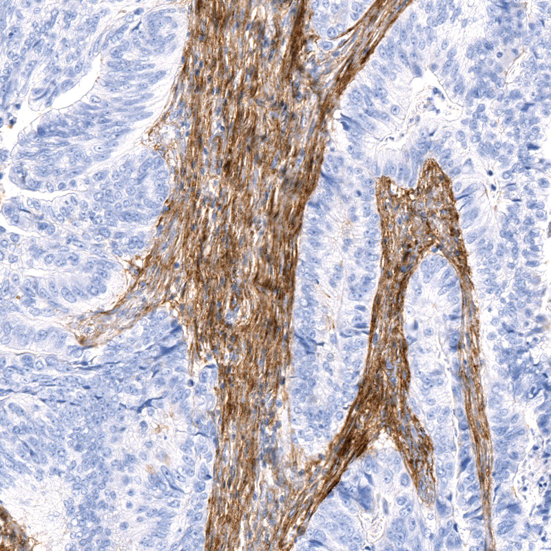 Anti-FBLN1 Recombinant Antibody