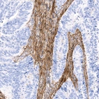 Anti-FBLN1 Recombinant Antibody