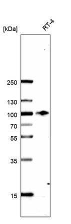 Western blot analysis in human cell line RT-4.