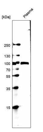 Western blot analysis in human cell line RT-4.