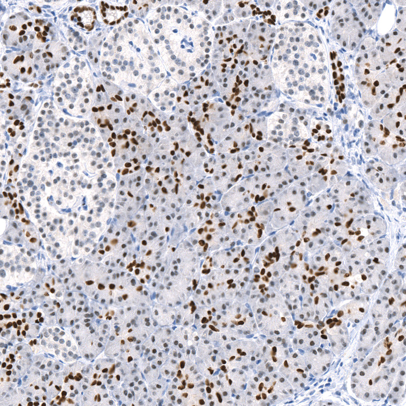 Anti-HNF1B Recombinant Antibody