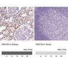 Immunohistochemistry analysis in human kidney and tonsil tissues using AMAb90733 antibody. Corresponding HNF1B RNA-seq data are presented for the same tissues.