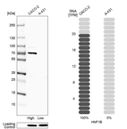 Western blot analysis in human cell lines Caco-2 and A-431 using Anti-HNF1B antibody. Corresponding HNF1B RNA-seq data are presented for the same cell lines. Loading control: Anti-PARP1.
