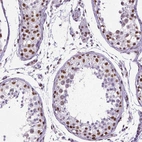 Immunohistochemical staining of human testis shows moderate to strong nuclear positivity in cells in seminiferous ducts.