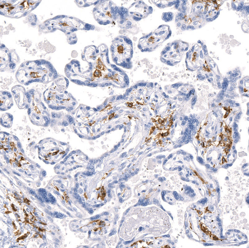 Anti-MRC1 Recombinant Antibody