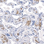 Anti-MRC1 Recombinant Antibody