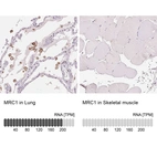 Immunohistochemistry analysis in human lung and skeletal muscle tissues using AMAb90746 antibody. Corresponding MRC1 RNA-seq data are presented for the same tissues.
