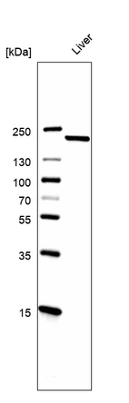 Western blot analysis in human liver tissue.