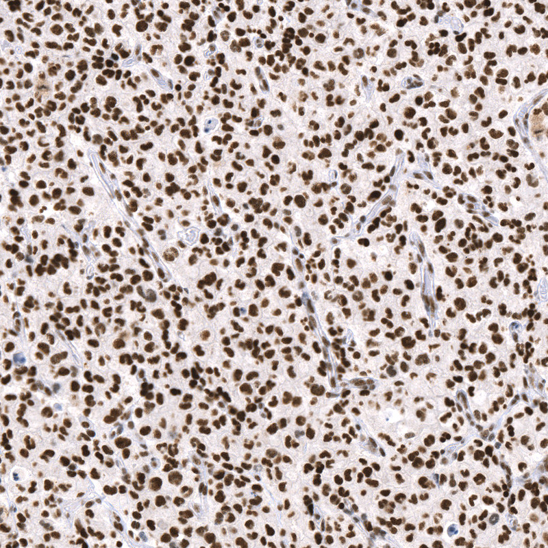 Anti-ATRX Recombinant Antibody
