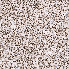 Anti-ATRX Recombinant Antibody
