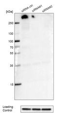 Western blot analysis in A-549 cells transfected with control siRNA, target specific siRNA probe #1 and #2, using Anti-ATRX antibody. Loading control: Anti-GAPDH.