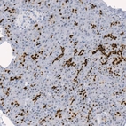 Immunohistochemical staining of human pancreas shows strong nuclear positivity in the intercalated ducts.