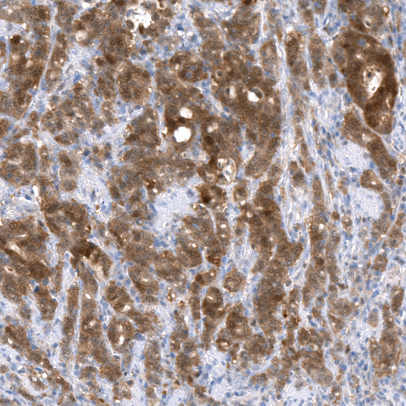 Anti-NAPRT Recombinant Antibody