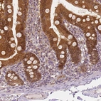 Immunohistochemical staining of human duodenum shows strong cytoplasmic positivity in glandular cells.