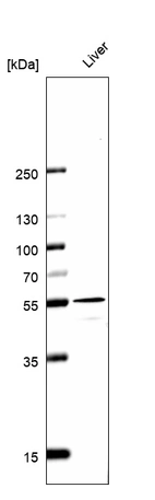 Western blot analysis in human liver tissue.