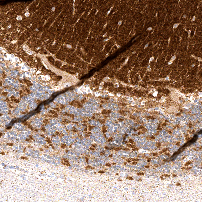Anti-RHOT1 Recombinant Antibody