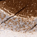 Anti-RHOT1 Recombinant Antibody