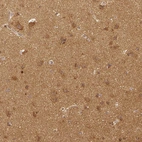 Immunohistochemical staining of human cerebral cortex shows moderate to strong cytoplasmic positivity in neuronal cells, as well as positivity in neuropil.