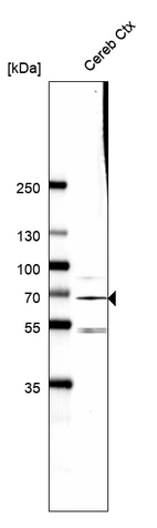 Western blot analysis in human cerebral cortex tissue.