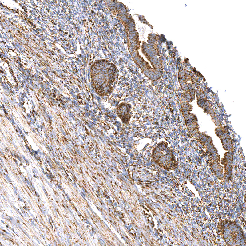Anti-TUFM Recombinant Antibody