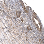 Anti-TUFM Recombinant Antibody