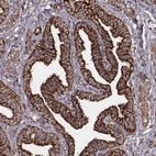 Immunohistochemical staining of human fallopian tube shows strong granular cytoplasmic positivity in glandular cells.