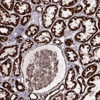 Immunohistochemical staining of human kidney shows strong granular cytoplasmic positivity in cells in tubules and moderate positivity in glomeruli.