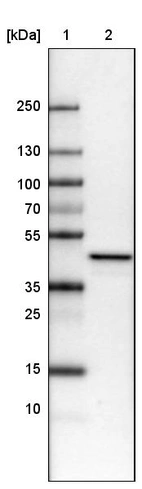 Lane 1: Marker [kDa]_br/_Lane 2: Human cell line U-251 MG