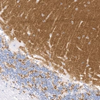Anti-SLC17A7 Recombinant Antibody