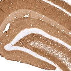 Immunohistochemical staining of rat hippocampus shows strong positivity in the neuropil of dentate gyrus and CA1 layer.